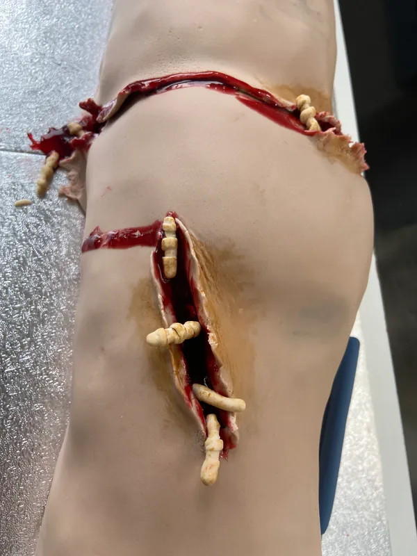 Forensic Doctors